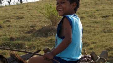 Imagem Batizado de "menino tartaruga", criança sofre de mutação rara