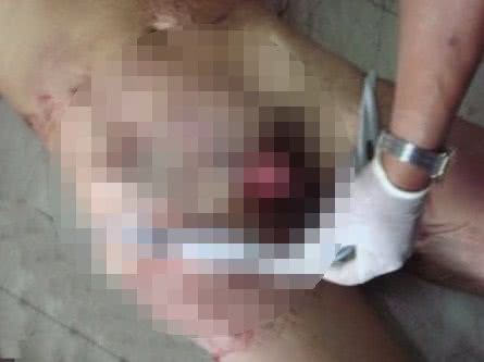 Imagem Mulher decepa pênis de homem que alegava exorcismo para cometer estupros