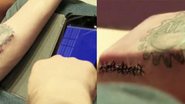 Imagem Hacker implanta chip do tamanho de smartphone sob pele do antebraço 