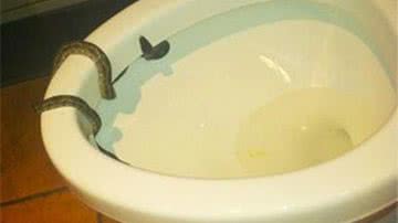 Imagem Homem leva mordida de cobra no pênis ao utilizar o vaso sanitário