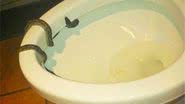 Imagem Homem leva mordida de cobra no pênis ao utilizar o vaso sanitário