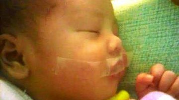 Imagem Enfermeiras teriam colado boca de bebê com fita para ele parar de chorar 