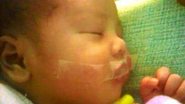 Imagem Enfermeiras teriam colado boca de bebê com fita para ele parar de chorar 