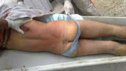 Imagem Assaltante morto em troca de tiros com a polícia usava calcinha