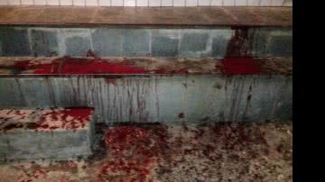 Imagem Casal é alvejado na Boa Vista de São Caetano