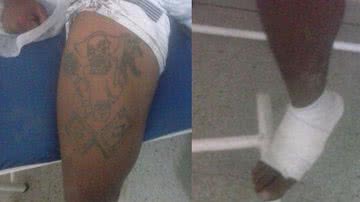 Imagem Homem baleado é preso dentro de hospital na Ilha