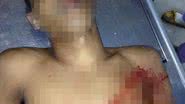 Imagem Homem troca tiros com policiais da Rondesp e morre no Uruguai