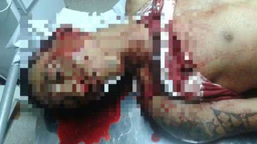 Imagem Homem suspeito de matar adolescente durante assalto é assassinado no Uruguai