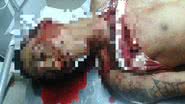 Imagem Homem suspeito de matar adolescente durante assalto é assassinado no Uruguai