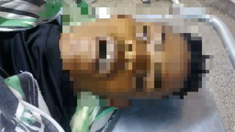 Imagem Coronel da PM é vítima de assalto e bandido é baleado na Pituba