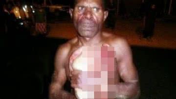 Divulgação / Emergência 190
