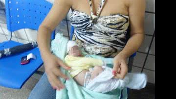 Imagem Mãe queima bebê com cigarro e tenta matar a filha