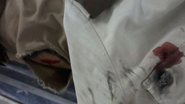 Imagem Policial é atingido de raspão após disparos feitos por deficiente mental