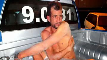 Imagem Marido morde orelha da companheira, arranca pedaço e come em Itabela