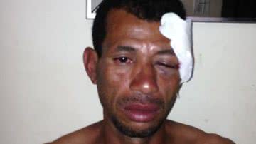 Imagem Acusado de estupro é espancado por populares ao lado do Shopping Bela Vista