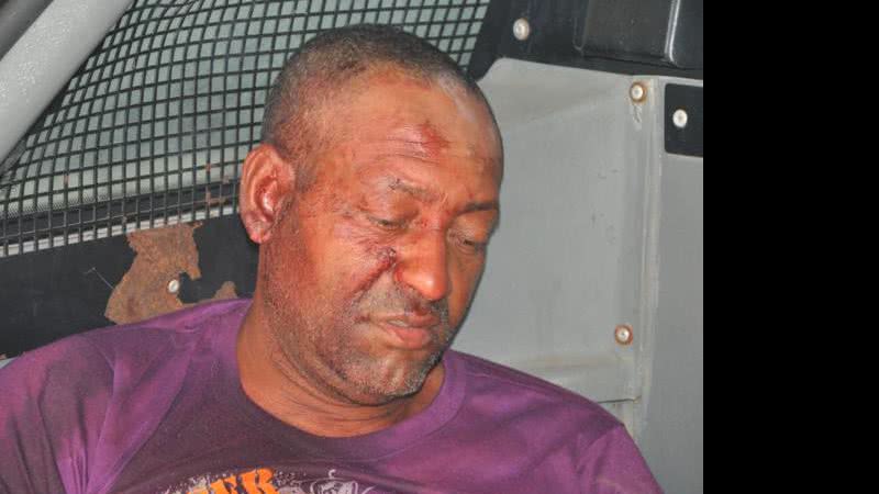 Imagem Homem é morto com diversos golpes de garrafa na cabeça