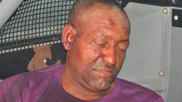 Imagem Homem é morto com diversos golpes de garrafa na cabeça