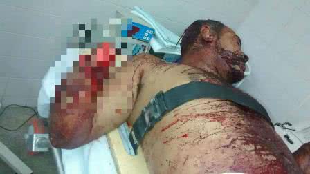 Imagem Pilão Arcado: homem acusado de roubar bodes tem mãos decepadas