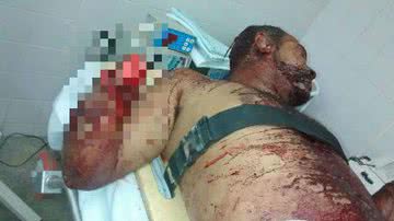 Imagem Pilão Arcado: homem acusado de roubar bodes tem mãos decepadas