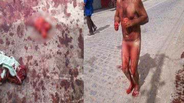 Imagem Homem transtornado arranca os próprios testículos no meio da rua