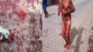 Imagem Homem transtornado arranca os próprios testículos no meio da rua