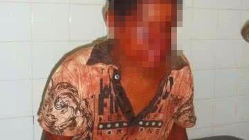 Imagem Homem é estuprado e espancado no interior baiano