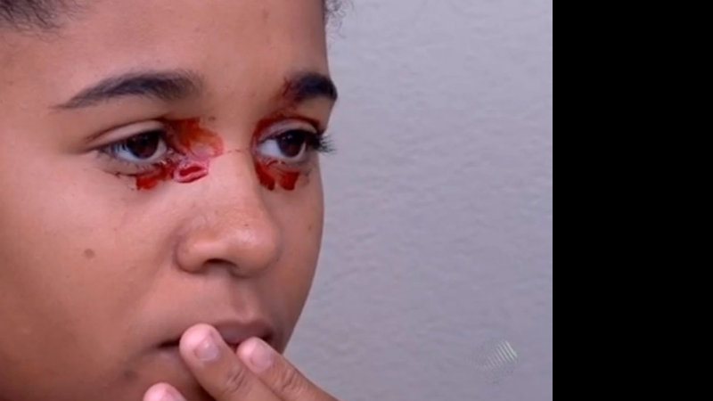 Imagem  Menina sangra pelos olhos e médicos não sabem a causa