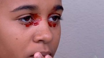 Imagem  Menina sangra pelos olhos e médicos não sabem a causa
