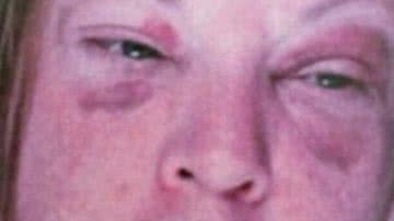 Imagem Mulher é presa após tentar cortar pênis do marido