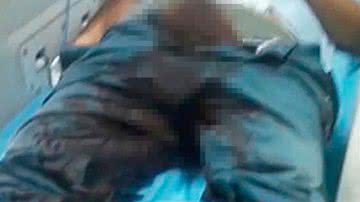 Imagem Homem tem frustração sexual, corta pênis e joga no lixo