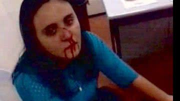 Imagem Advogada acusa policial de quebrar nariz com uma cabeçada