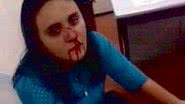Imagem Advogada acusa policial de quebrar nariz com uma cabeçada