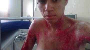 Imagem Mulher acusada de jogar ácido em rival é presa em Itapuã