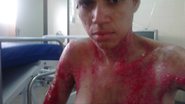 Imagem Mulher acusada de jogar ácido em rival é presa em Itapuã