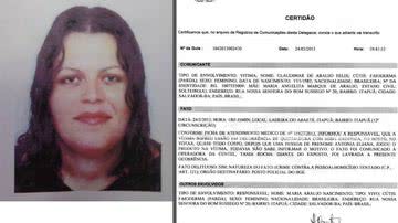 Imagem Fotos: por ciúmes, mulher ataca outra com ácido em Itapuã