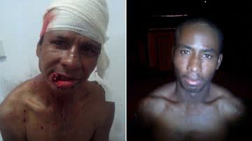 Imagem Homem é preso após cortar os lábios de vítima com facão