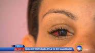 Imagem Após ser dada como morta, mulher acorda e denuncia autora