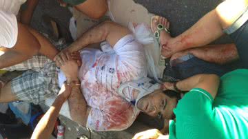 Imagem Rodoviários cobram julgamento de motorista que atropelou médico e família