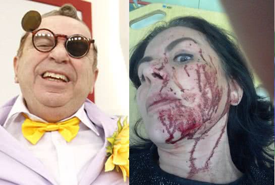 Imagem Mulher do humorista Castrinho é baleada e compartilha foto no Facebook