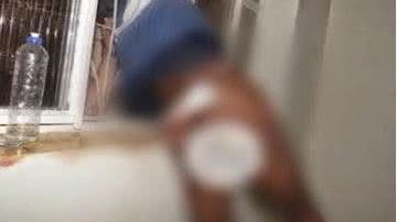 Imagem   Nu e sangrando, ladrão fica entalado ao tentar furtar residência pela 4ª vez