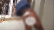 Imagem   Nu e sangrando, ladrão fica entalado ao tentar furtar residência pela 4ª vez
