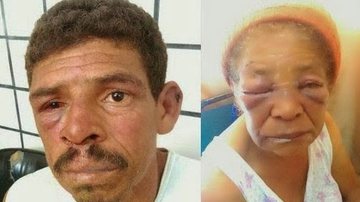 Imagem Una: homem espanca a sogra de 71 anos