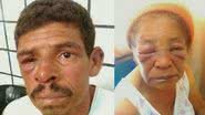 Imagem Una: homem espanca a sogra de 71 anos