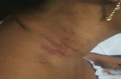 Imagem Falsa grávida tenta roubar bebê em Santo Amaro