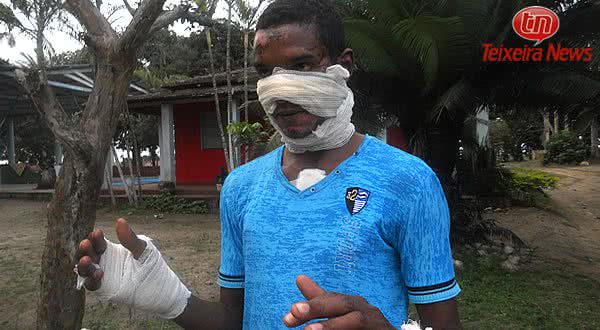 Imagem Briga entre moradores de rua deixa um com rosto queimado de solvente