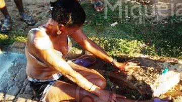 Imagem Mulher ateia fogo no próprio corpo em Irecê