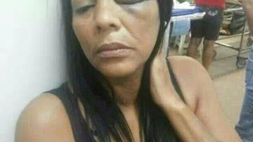 Imagem Guardas municipais agridem mulher na Lapa, denunciam PMs
