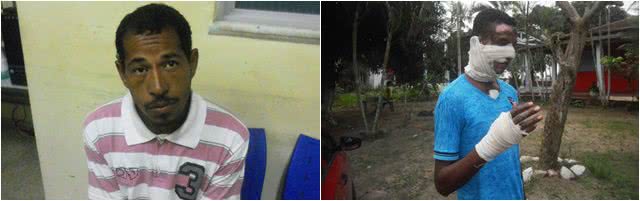 Imagem  Teixeira de Freitas: acusado de atear fogo em morador de rua é preso
