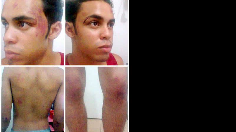 Imagem Agredido em Salvador, jovem acredita ter sido vítima de homofobia