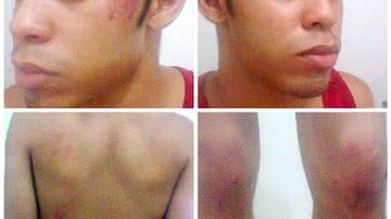 Imagem Agredido em Salvador, jovem acredita ter sido vítima de homofobia